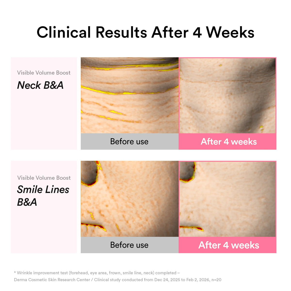 Abib PDRN Volume fill-it booster crème 2.5 tube