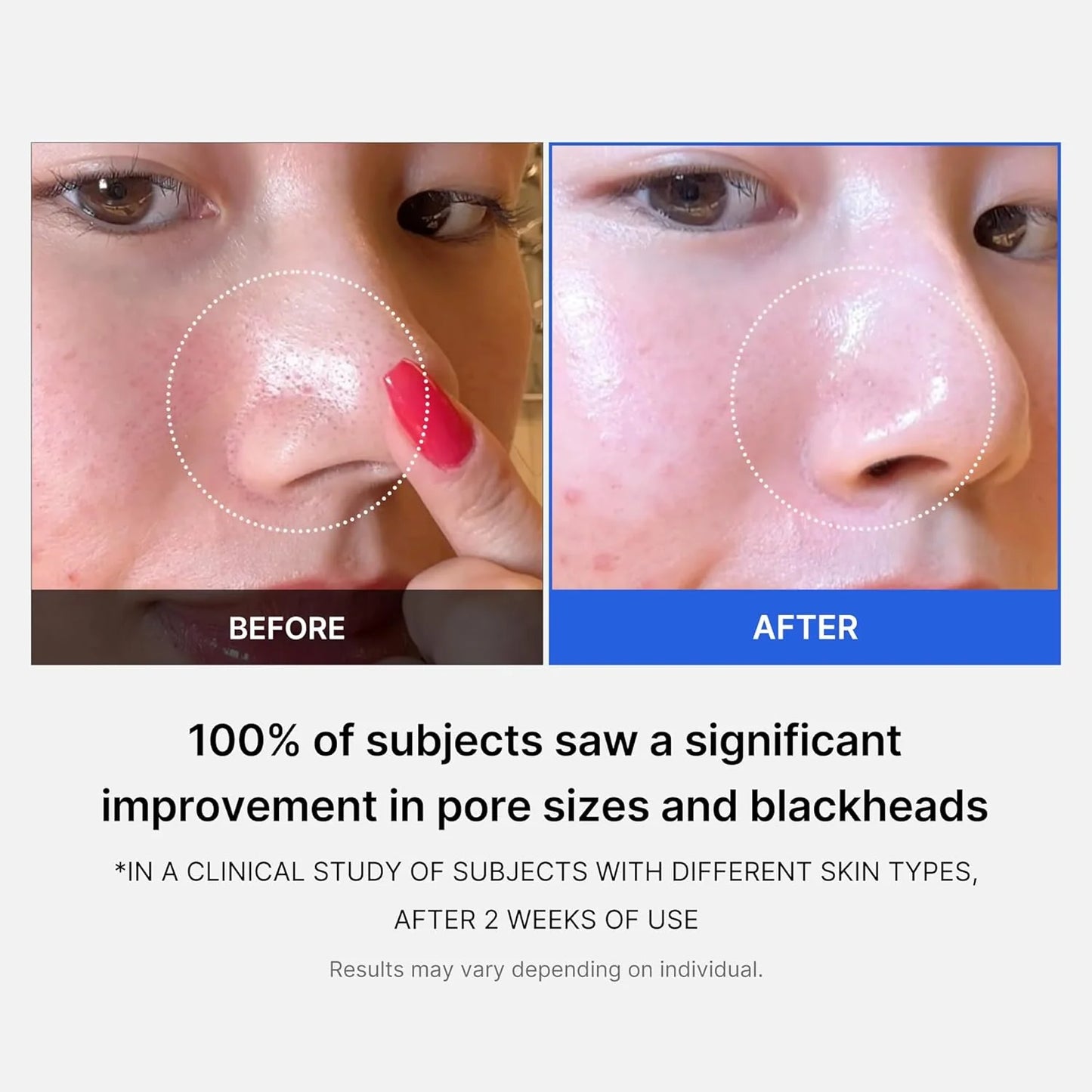 Medicube Zero Pore Pad